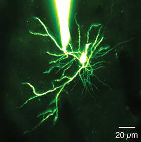 Illustration for article titled Biologists Discover Tiny Neural Computers in the Brain